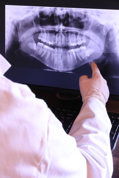 Best Emergency Dental Care for Broken or Chipped Teeth in Union City, CA